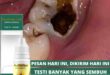 cara mengobati gigi berlubang agar tidak kambuh lagi_ef2eefd3d.jpg