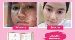 cara merawat muka kusam berminyak dan berjerawat_48ceb51fc.jpg