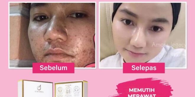 cara merawat muka kusam berminyak dan berjerawat_48ceb51fc.jpg