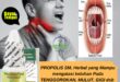 cara mengatasi bau mulut akibat gigi berlubang_25b085818.jpg